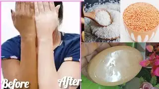 masoor dal soap benefits//homemade skin whitening and glowing soap / rice & masoor dal soap