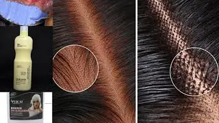 The best way to bleach your frontal wig knots 2025
