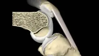 Knee Flexion & Patellar Motion Animation, &copy;Primal Pictures Ltd