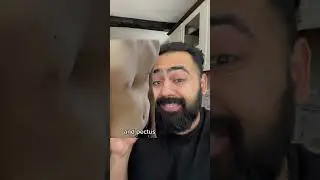 Doctor Explains Pigeon Software Update!