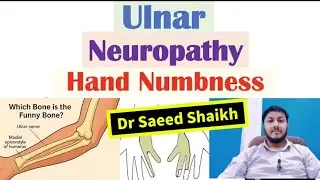 Elbow Pain Relief | Ulnar Neuropathy Physiotherapy Treatment & Exercises | Nerve Compression #elbow