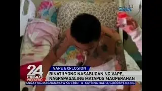 Binatilyong nasabugan ng vape, nagpapagaling matapos maoperahan