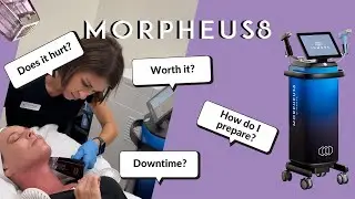 Morpheus8 Treatment & Recovery Vlog