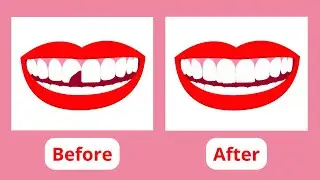 New Drug Could Help Humans Grow New Teeth by 2030