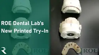 ROE's new Printed Try-In