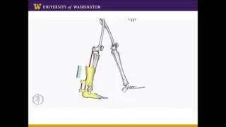 Achilles tendon length with ankle foot orthoses