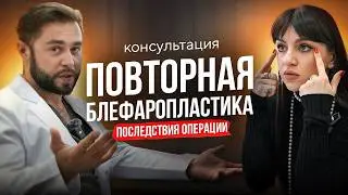 КОНСУЛЬТАЦИЯ С ПАЦИЕНТКОЙ ИРИНОЙ ХРУЩИНСКОЙ I БЛЕФАРОПЛАСТИКА БЛЕФАРОПЛАСТИКА ПОСЛЕ ДРУГОГО ХИРУРГА