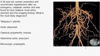 Charit&eacute; Clinical Journal Club by Fred Luft - 17.8.2016