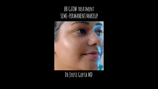 BB Glow Facial Treatment | SEMI-PERMANENT Alternative To Daily Foundation #shorts