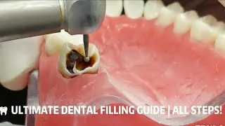 ASMR Full Tooth Filling | No Fast-Forward, Save-Worthy#TeethRepairASMR #DentalDIY