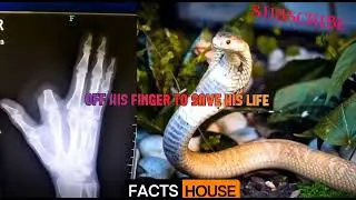 Incredible True Stories You Won't Believe Happened! | Snake Venom, Pyramid Climb & More