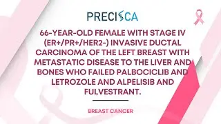 Expert Cancer Panel: Stage IV IDC w/ metastases s/p palbociclib/letrozole and alpelisib/fulvestrant