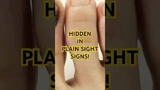 Your Nails Are Sending You Health Warnings&mdash;Look Closely! #healthtips #facts #health