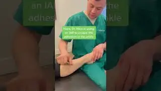 The Best Treatment for Shin Splints! Expert Chiropractor Denville NJ #shorts
