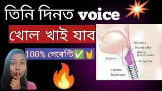 তিনি দিনত গলা তথা কণ্ঠ খোল খাই যাব 100%গেৰেন্টি /how to open up your voice Assamese #kkmusicalসহায়