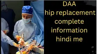 DAA hip replacement complete information / cost / stay / physio free