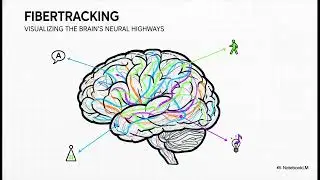 Brainlab Elements: The Software Revolutionizing Modern Surgery 🧠✨