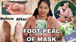 Get Ready for the MOST VIRAL Foot Peel Mask of 2025