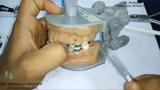 OPEN COIL RETRACTION SPRING-1