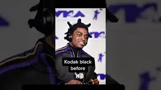 Rappers before and after drugs 💊😯