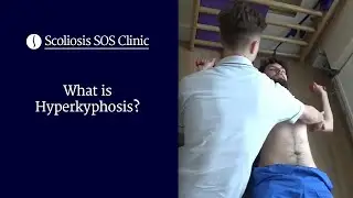 What is Hyperkyphosis? | Scheuermann's Disease & Bad Posture