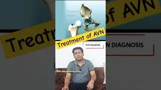 Treatment of AVN in Ayurveda Homeopathy Allopathy #AVN #ayurveda #ayurvedic #ayurved #homeopathy