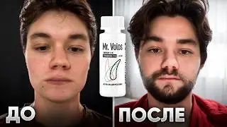 ОТРАСТИЛ БОРОДУ ЛЕСНИКА с НУЛЯ. Результаты применения Mr.VOLOS 5% и 15%