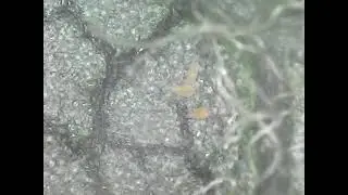 Rust mite in Apple Plant leaf. Mites under microscope. Sucking insect in Apple Tree. Rust mite