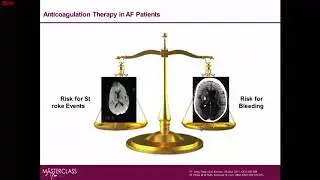 Unchanging Principle: Why NOACs used to reduce stroke and bleeding risk for AF patients