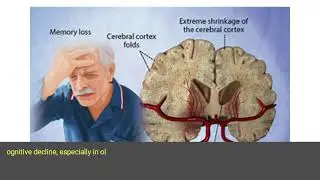 A Sedentary Lifestyle and Cognitive Function