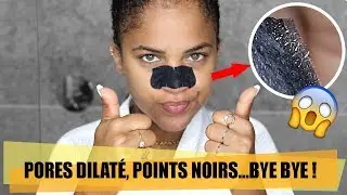 POINTS NOIRS, PORES DILATÉS : DITES STOP ! 🙅🏽‍♀️