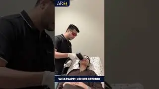 Laser Hair Removal - Diode Laser