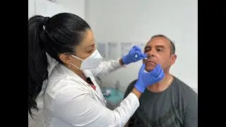 Relleno de Líneas de Marioneta con Ácido Hialurónico. Clínica Merced 👩‍⚕️👨‍⚕️