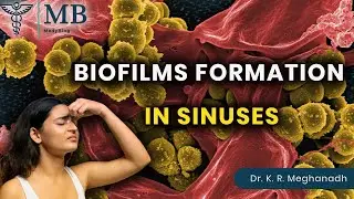 How Biofilms Form in Sinuses| Dr. K. R. Meghanadh | Medyblog