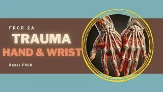 1 - MSK & Trauma Imaging for FRCR