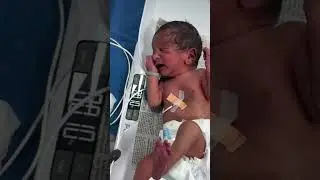 January 9, 2026#viralvideo #viralshorts #nurseryrhymes #nicucare #ytstudioes 🙏💯🙏💯