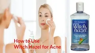 How to Use Witch Hazel for Acne
