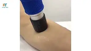 portable shockwave eswt pain relief air pressure system therapy device #danyelaser #shockwaves