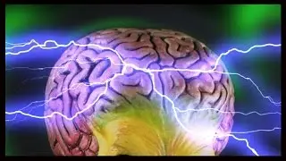 Electric Surge To Brain When Falling Asleep