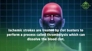 CBD and Stroke recovery