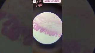 T.S of gall bladder under microscope