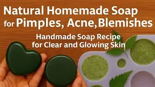 Natural Homemade Soap for Pimples, Acne, Blemishes | Handmade Soap Recipe for Clear and Glowing Skin