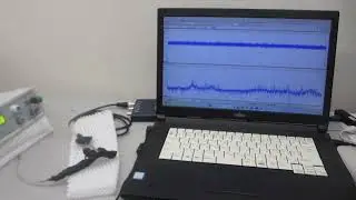 オリジナル非線形共振現象を制御可能にする、超音波プローブの製造技術を開発