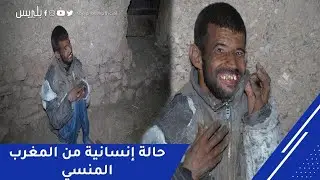من المغرب المنسي.. حالة إنسانية تدمي القلب والأب يناشد المحسنين: 
