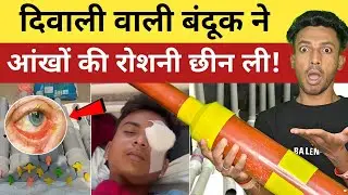 Why Carbide Gun Is Injurious For Eyes || दिवाली वाली बंदूक ने आंखों की रोशनी छीन ली !