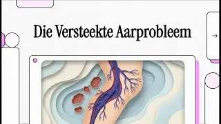 158 Die Versteekte Aarprobleem