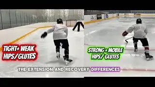 ACCELERATION MECHANICS- TIGHT/WEAK VS STRONG/ MOBILE HIPS