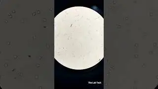 Budding Yeast in Urine🔬 #urine #Yeast #abnormal
