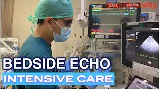 Bedside hemodynamic echocardiography in intensive cardiac care unit
