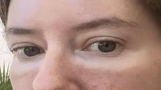 how to get rid of glasses tan line on nose